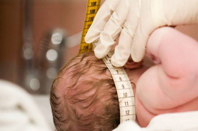 Rio lança projeto de acolhimento de gestantes portadoras do vírus Zika