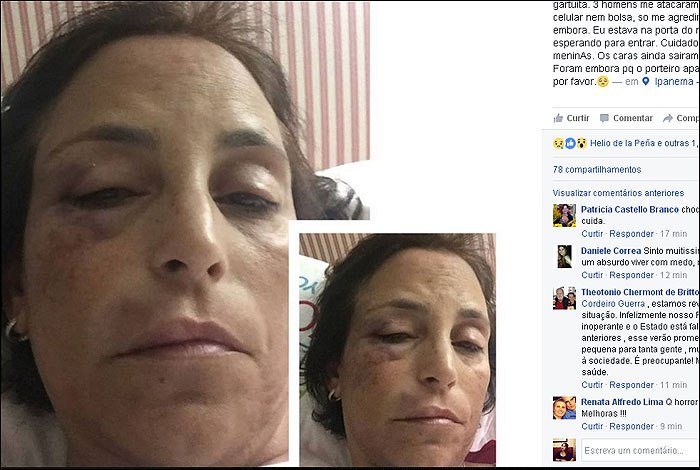 Empresária é espancada em frente ao seu prédio em Ipanema