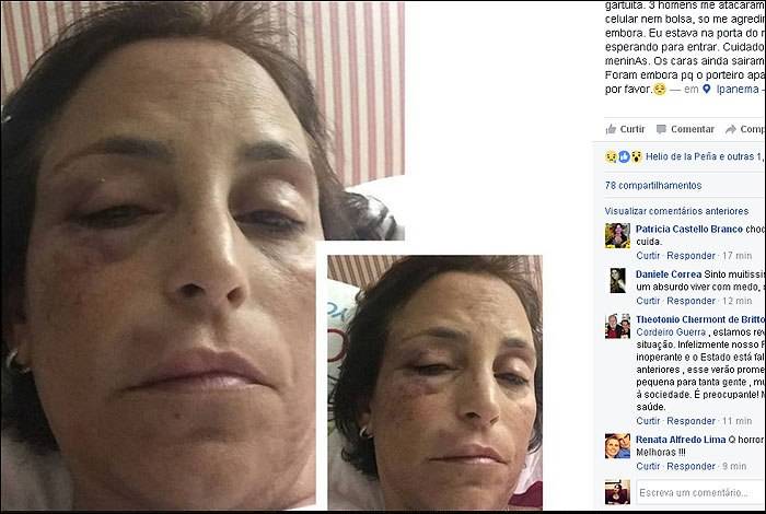 Empresária é espancada em frente ao seu prédio em Ipanema