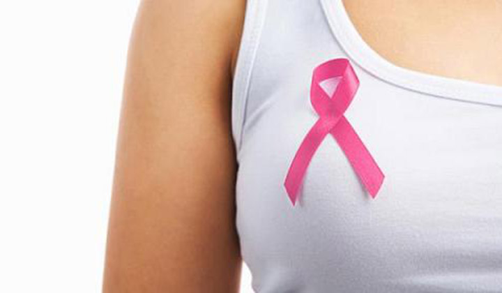 Rio Imagem faz mamografias sem agendamento durante Outubro Rosa