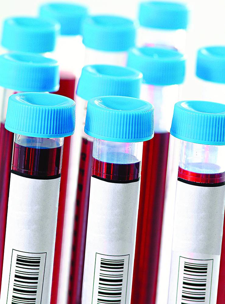 INCA sofre com baixa doação de sangue