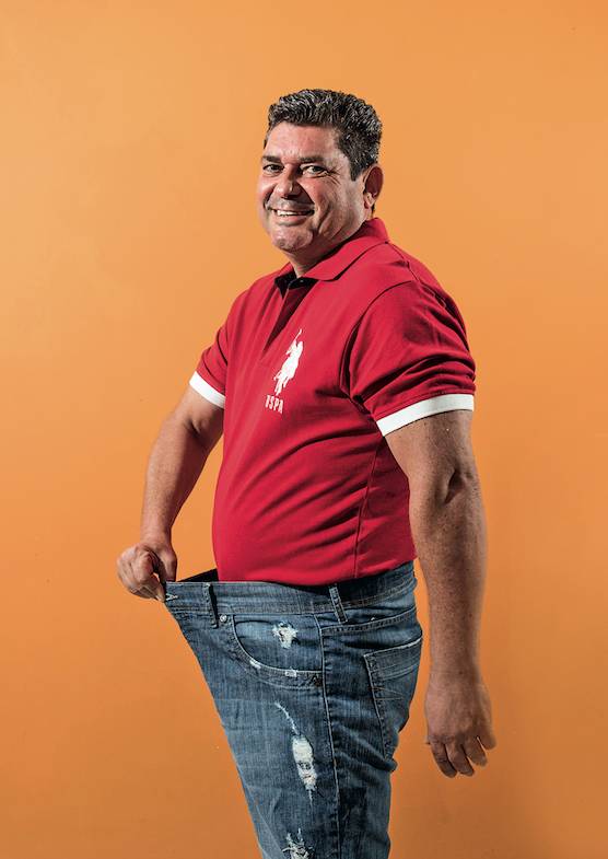 Método por endoscopia promete redução do estômago mais simples