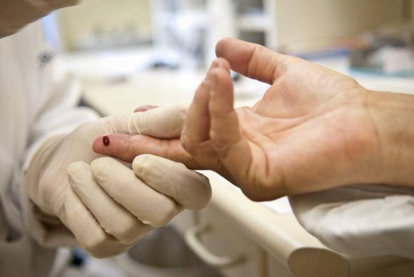 SUS oferecerá remédio que previne contaminação da AIDS