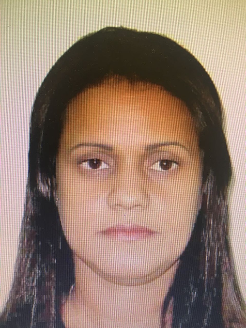 Mulher é detida por aplicar silicone industrial em pacientes no Rio