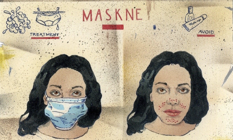 Os 5 passos para evitar Maskne