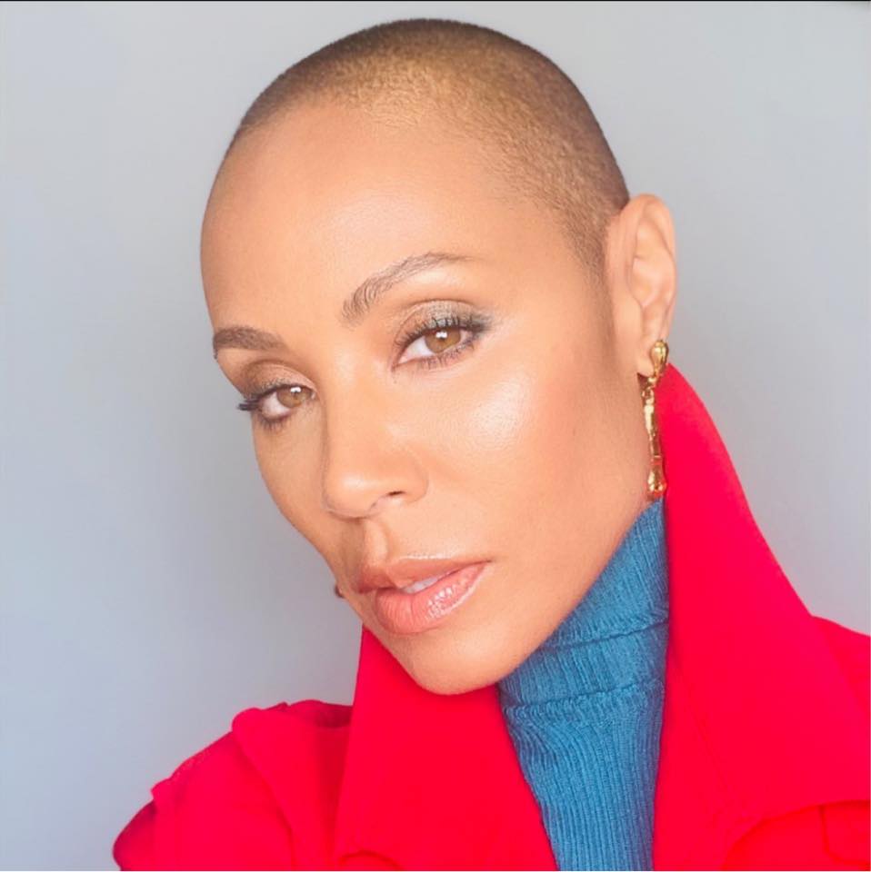 Alopecia areata: entenda a doença que virou o grande tema do Oscar