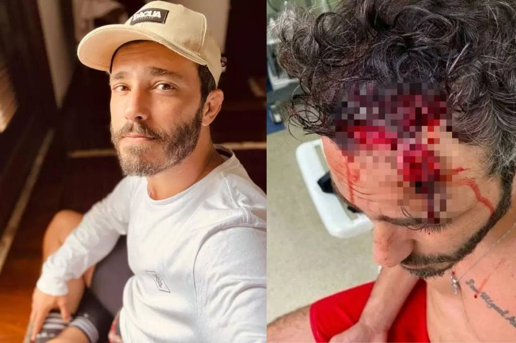Quem é o ator que ficou desacordado após assalto na Gávea