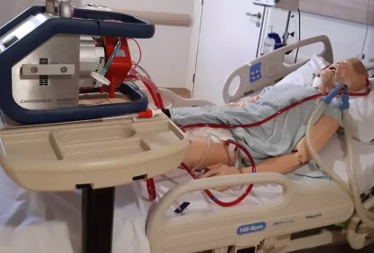 Simulação do uso da terapia ECMO divulgação Hospital santa catarina