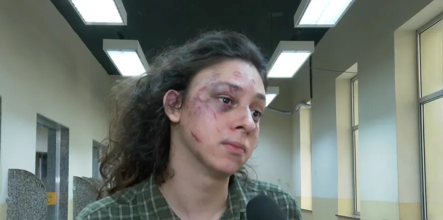 Novo vídeo mostra que ator Victor Meyniel levou 42 socos em 37 segundos