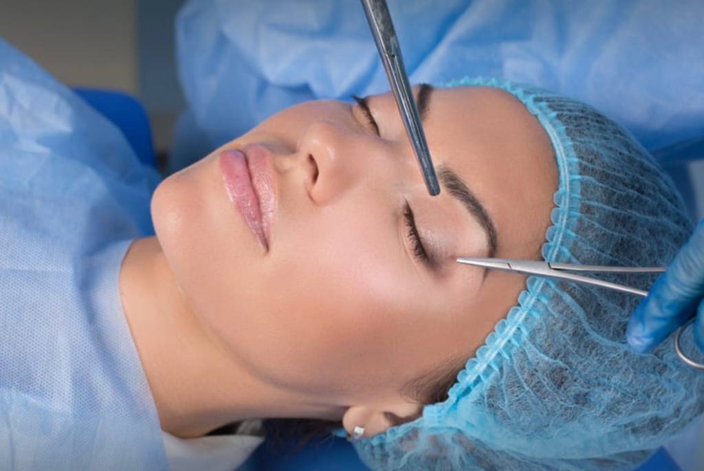 Pálpebra caída? O que você precisa saber antes de fazer Blefaroplastia