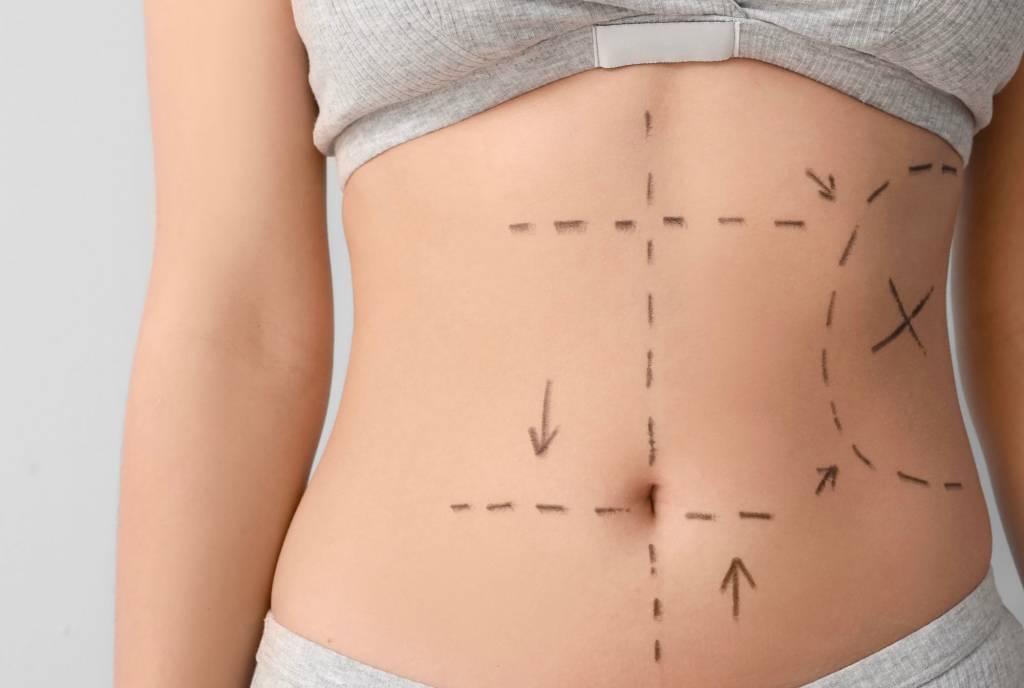 ‘Doutor, a barriga pode voltar?’