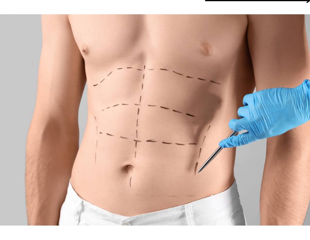 Número de homens que recorrem à cirurgia plástica aumenta